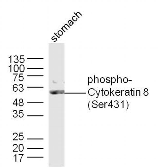 Phospho-Cytokeratin 8 (Ser431) Antibody in Western Blot (WB)