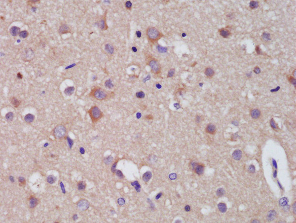 Dynorphin A/Proenkephalin B Antibody in Immunohistochemistry (Paraffin) (IHC (P))