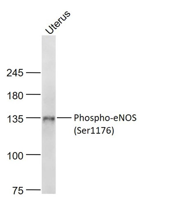 Phospho-eNOS (Ser1176) Antibody in Western Blot (WB)