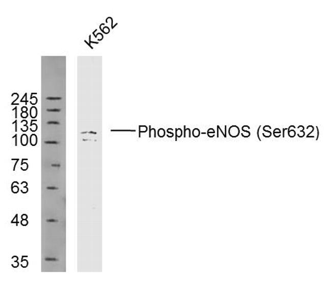 Phospho-eNOS (Ser633) Antibody in Western Blot (WB)