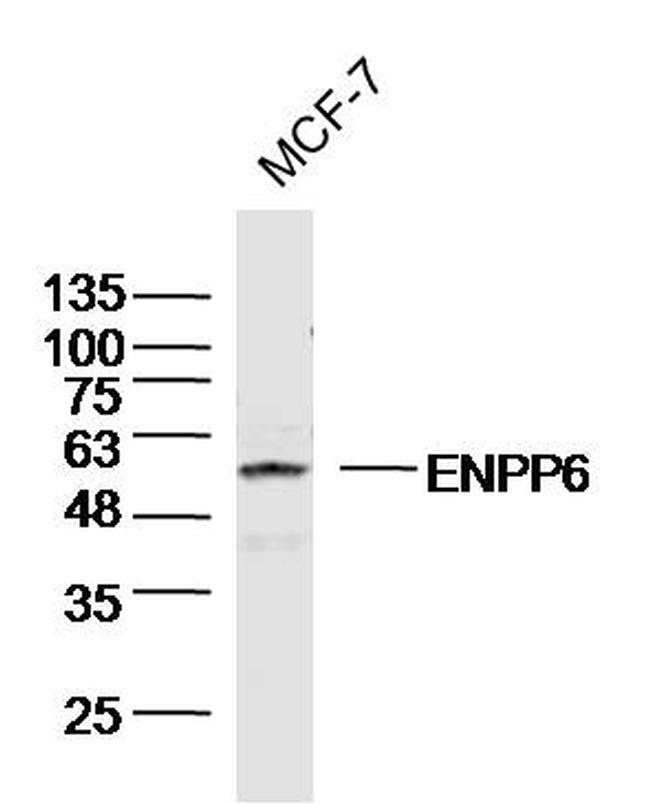ENPP6 Antibody in Western Blot (WB)