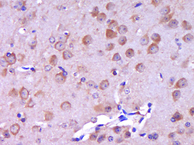 Phospho-HER4 (Tyr1258) Antibody in Immunohistochemistry (Paraffin) (IHC (P))