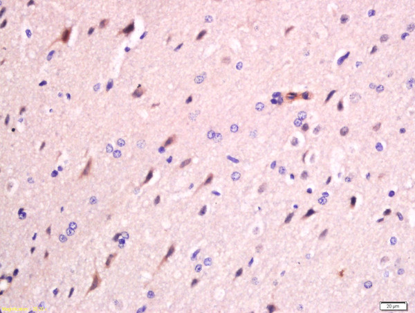 FAM134B Antibody in Immunohistochemistry (Paraffin) (IHC (P))