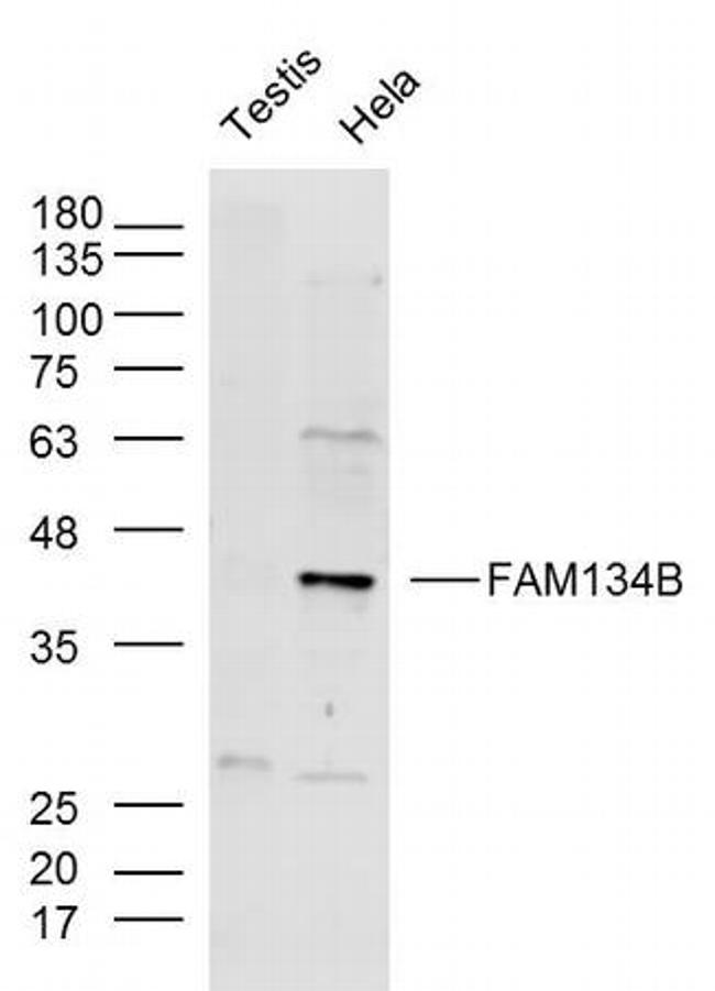 FAM134B Antibody in Western Blot (WB)