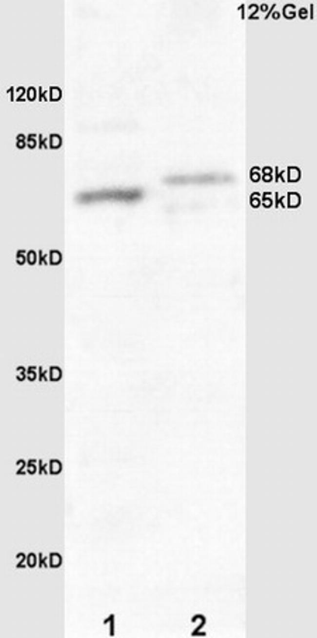 Frizzled 10/CD350 Antibody in Western Blot (WB)