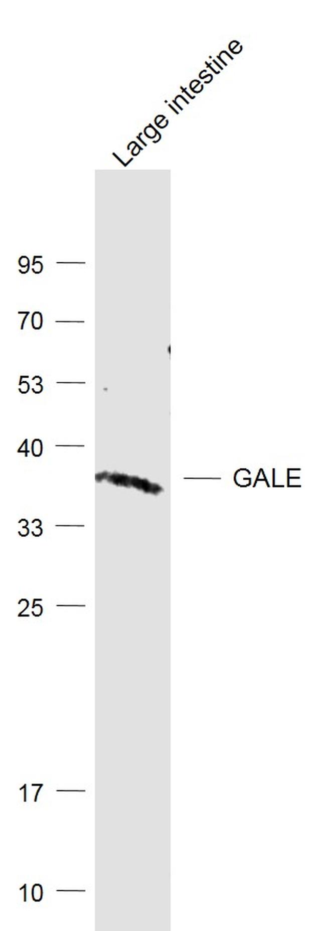 GALE/Galactowaldenase Antibody in Western Blot (WB)