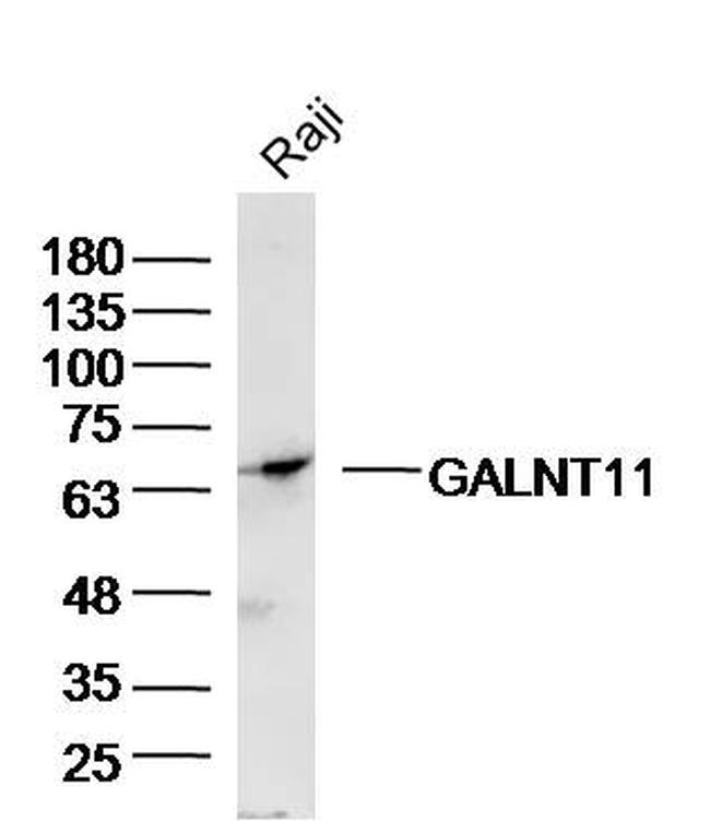 GALNT11/GalNAc-T11 Antibody in Western Blot (WB)