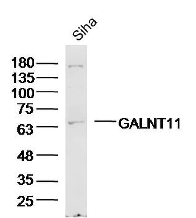 GALNT11/GalNAc-T11 Antibody in Western Blot (WB)
