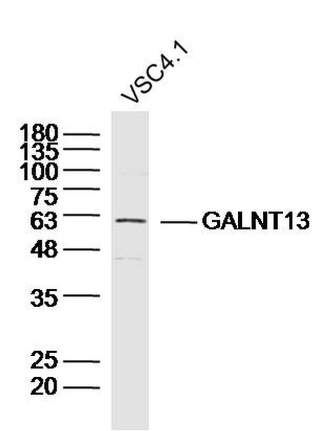 GALNT13/GalNAc-T13 Antibody in Western Blot (WB)