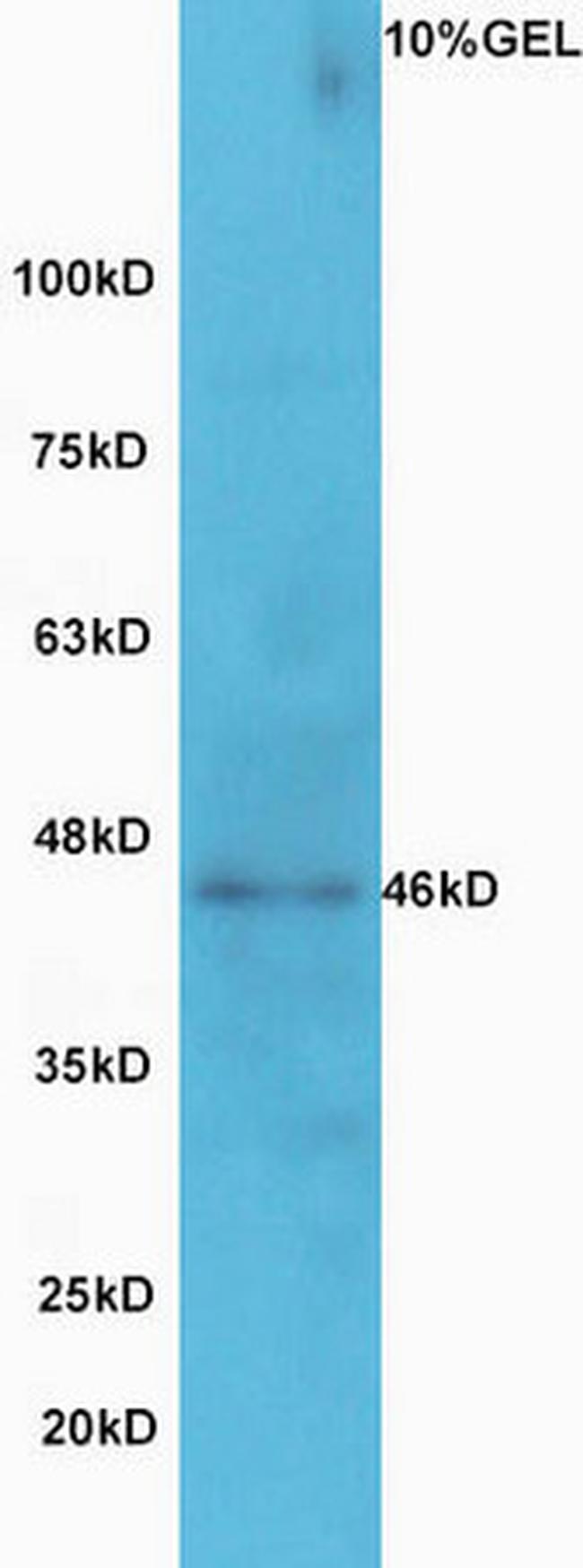 GCNT2 Antibody in Western Blot (WB)
