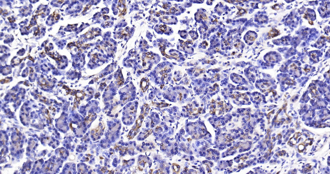 CK18 Antibody in Immunohistochemistry (Paraffin) (IHC (P))