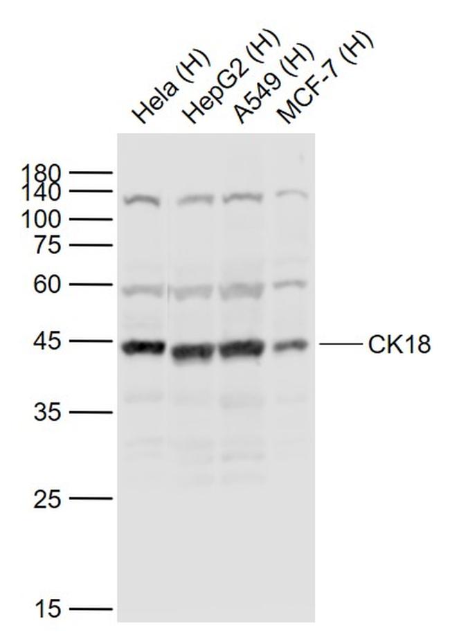 CK18 Antibody in Western Blot (WB)