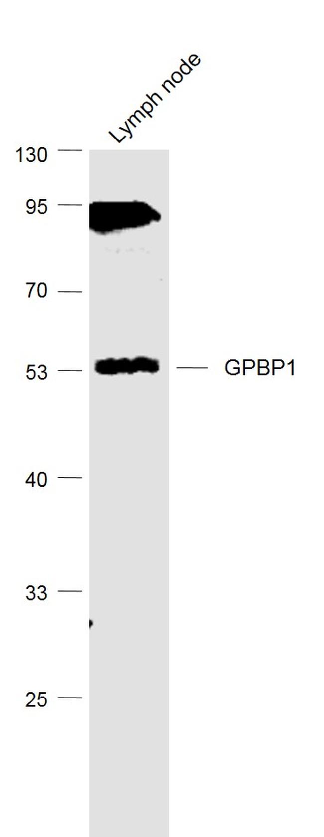 GPBP1/Vasculin Antibody in Western Blot (WB)