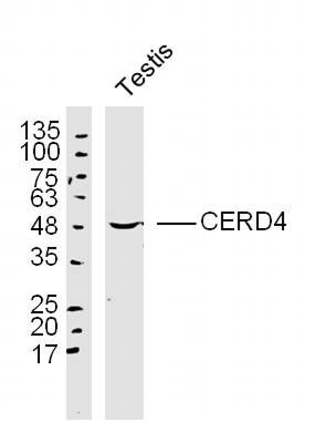 CERD4 Antibody in Western Blot (WB)