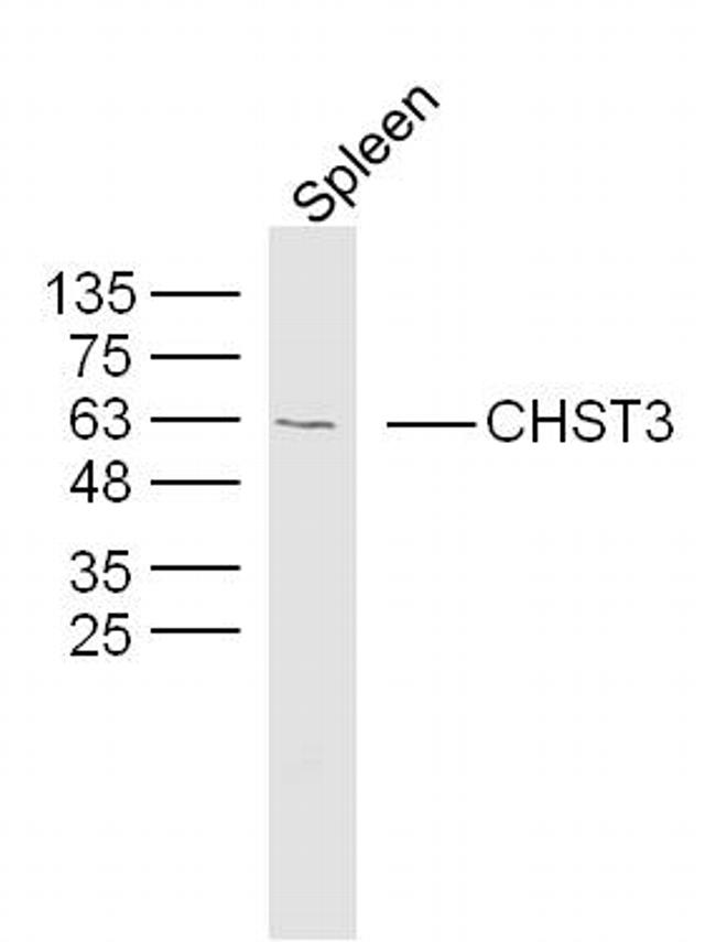 CHST3 Antibody in Western Blot (WB)