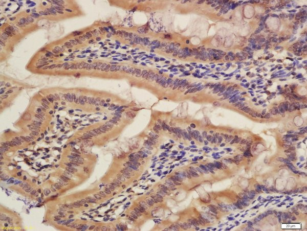 CISD1 Antibody in Immunohistochemistry (Paraffin) (IHC (P))