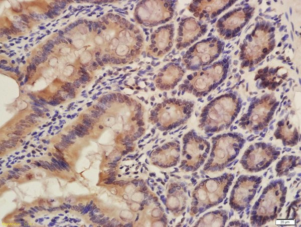 CISD1 Antibody in Immunohistochemistry (Paraffin) (IHC (P))