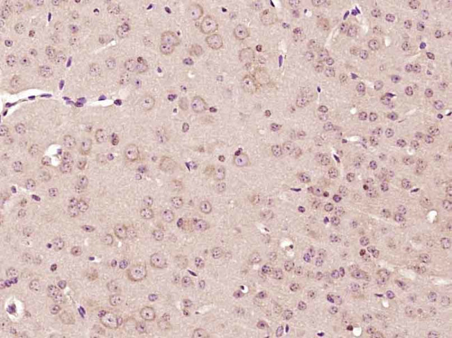 CHST7 Antibody in Immunohistochemistry (Paraffin) (IHC (P))