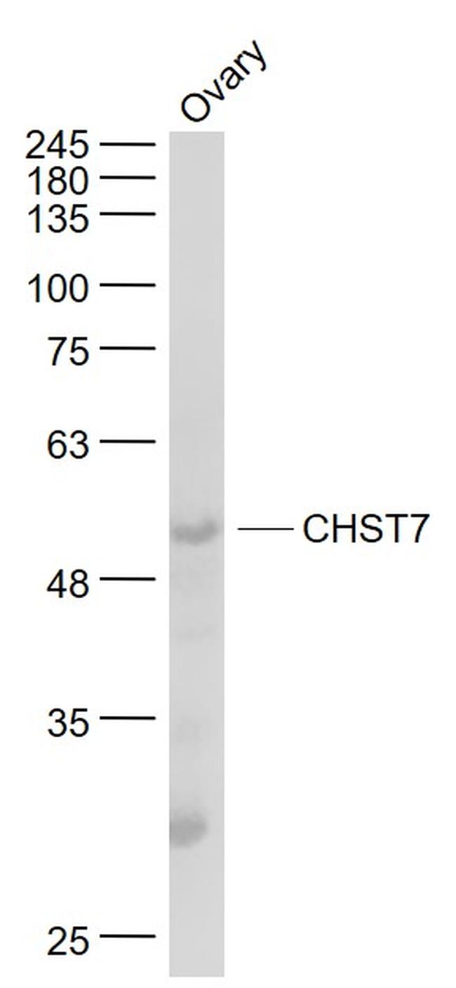 CHST7 Antibody in Western Blot (WB)