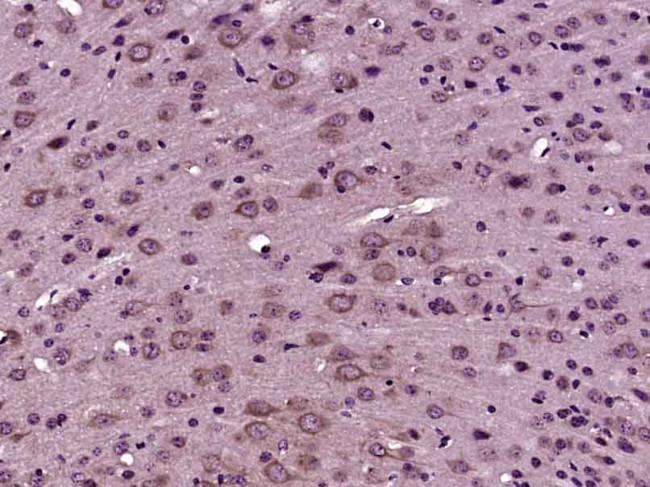 CTU2 Antibody in Immunohistochemistry (Paraffin) (IHC (P))