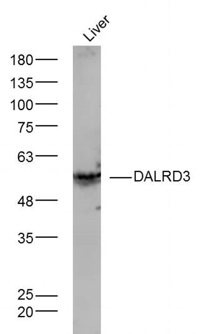 DALRD3 Antibody in Western Blot (WB)