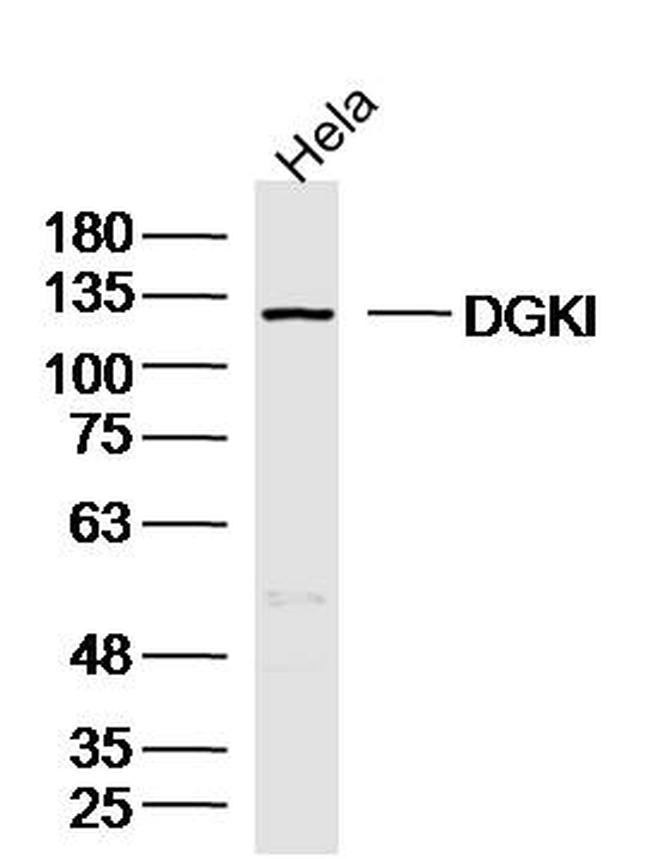 DGKI Antibody in Western Blot (WB)