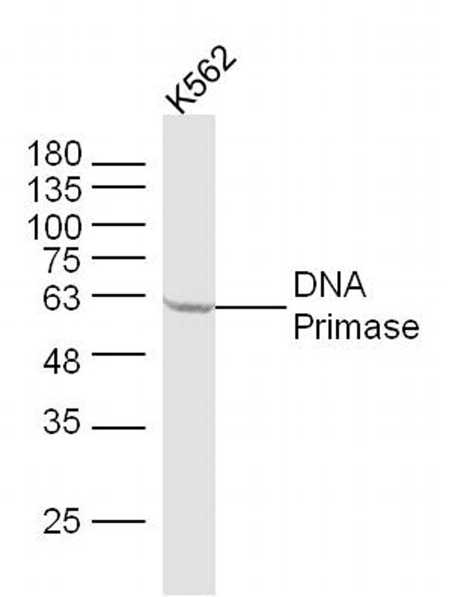 DNA Primase Antibody in Western Blot (WB)
