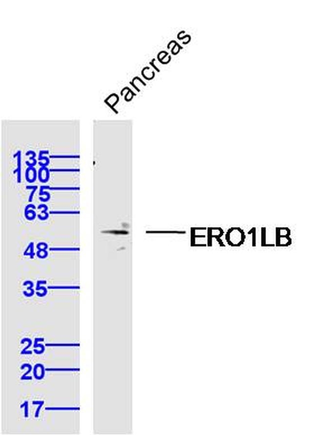 ERO1LB Antibody in Western Blot (WB)