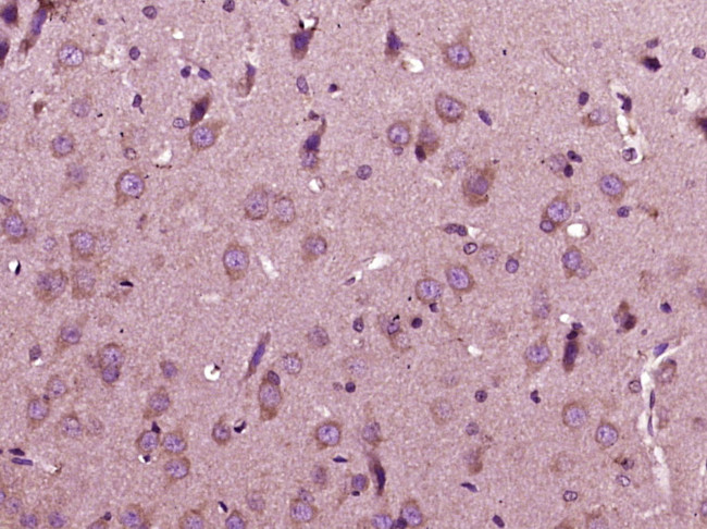 IL-12 Antibody in Immunohistochemistry (Paraffin) (IHC (P))