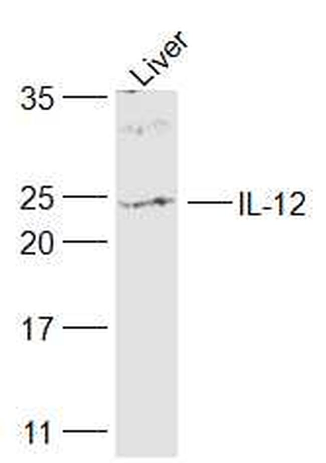 IL-12 Antibody in Western Blot (WB)