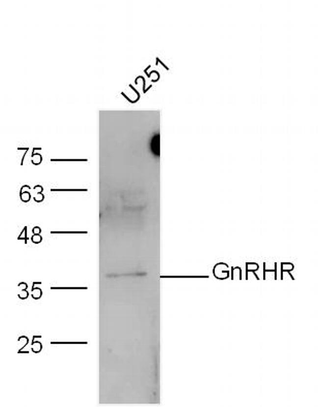 GnRHR Antibody in Western Blot (WB)