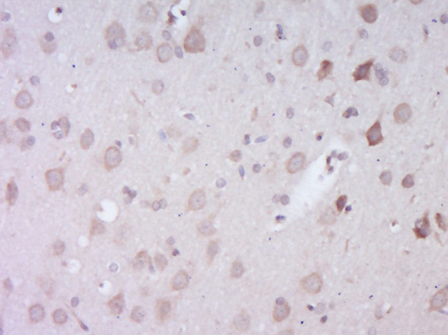 EXOC1 Antibody in Immunohistochemistry (Paraffin) (IHC (P))