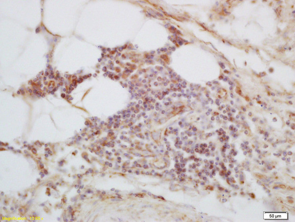 C1orf106 Antibody in Immunohistochemistry (Paraffin) (IHC (P))