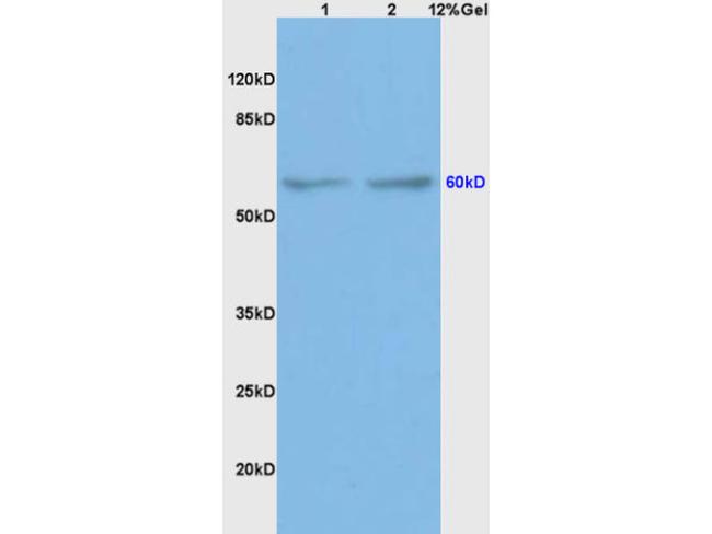 BMPR1A/CD292 Antibody in Western Blot (WB)