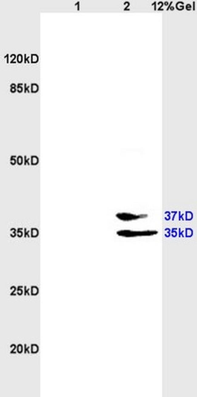 EpCAM/CD326 Antibody in Western Blot (WB)