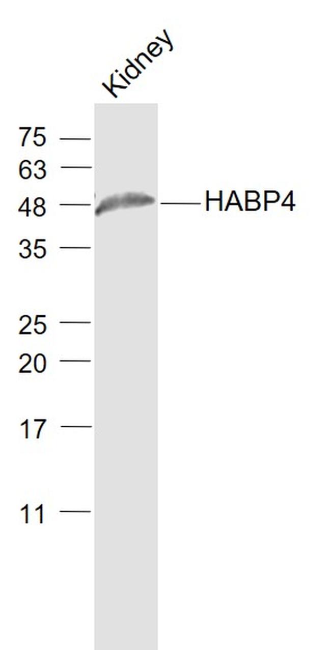 HABP4 Antibody in Western Blot (WB)