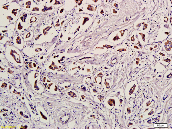 Ubiquitin Antibody in Immunohistochemistry (Paraffin) (IHC (P))