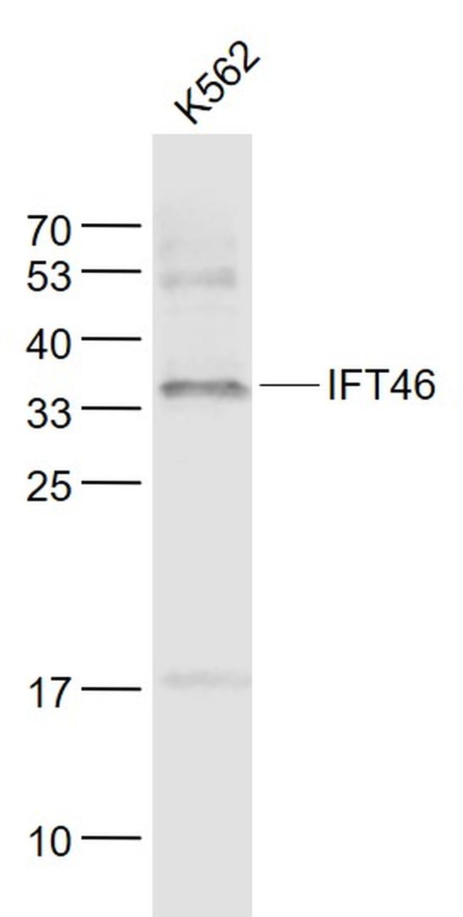 IFT46 Antibody in Western Blot (WB)