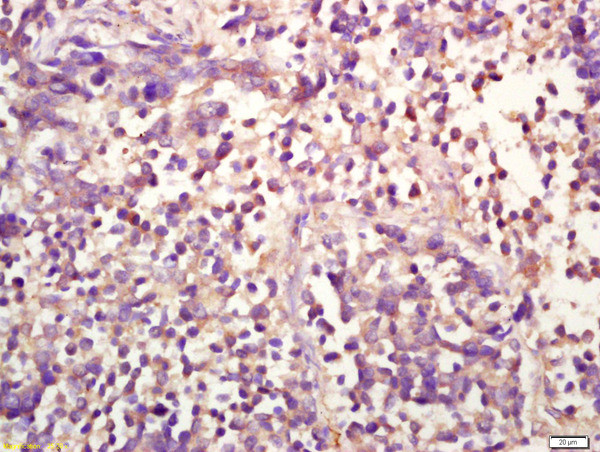 Phospho-ERK1 (Thr183, Tyr185) Antibody in Immunohistochemistry (Paraffin) (IHC (P))