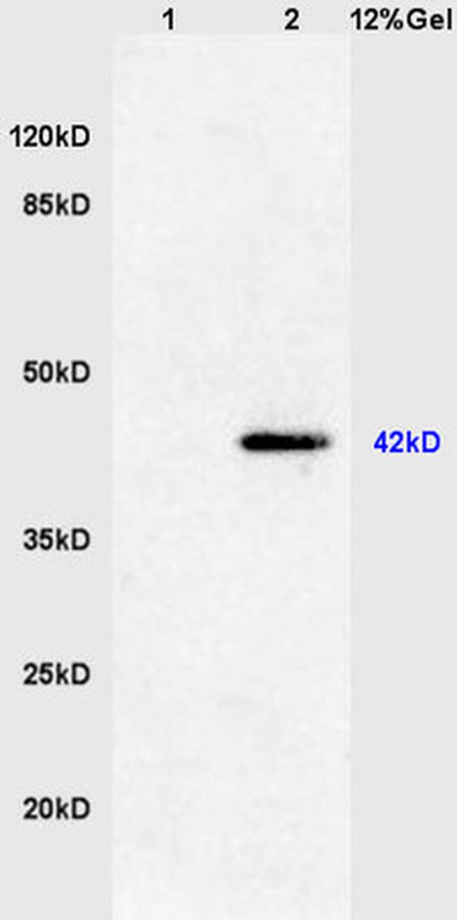 Phospho-ERK1 (Thr183, Tyr185) Antibody in Western Blot (WB)