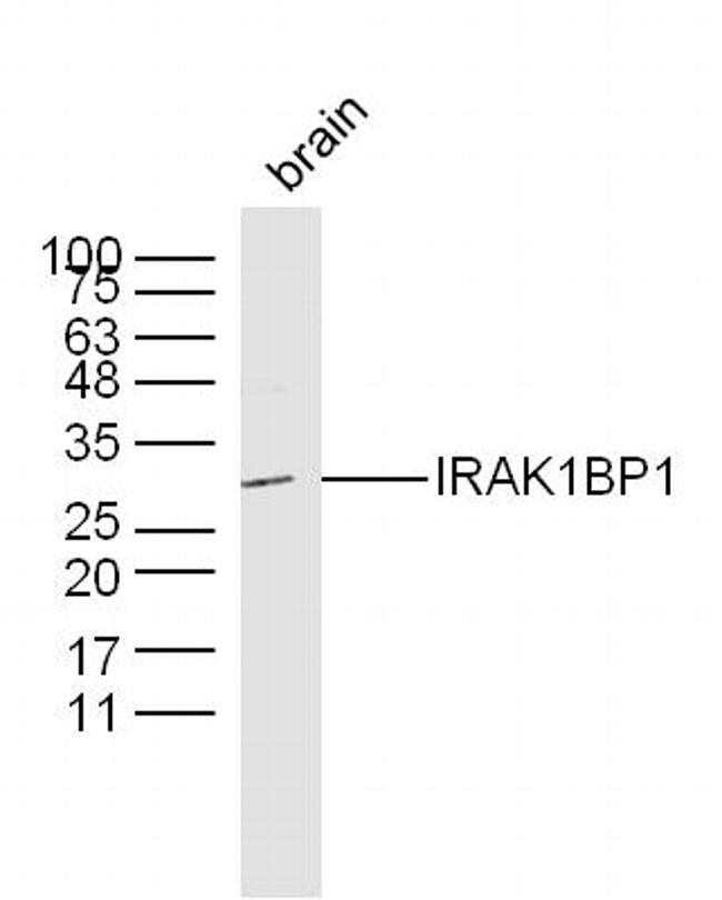 IRAK1BP1 Antibody in Western Blot (WB)