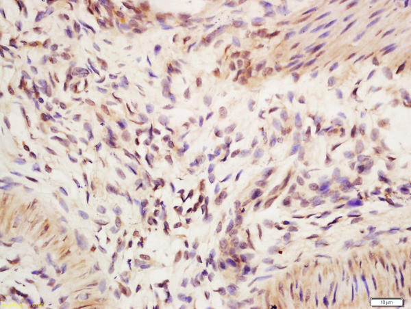 IRF2 Antibody in Immunohistochemistry (Paraffin) (IHC (P))