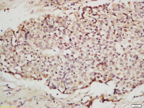 IRF2 Antibody in Immunohistochemistry (Paraffin) (IHC (P))