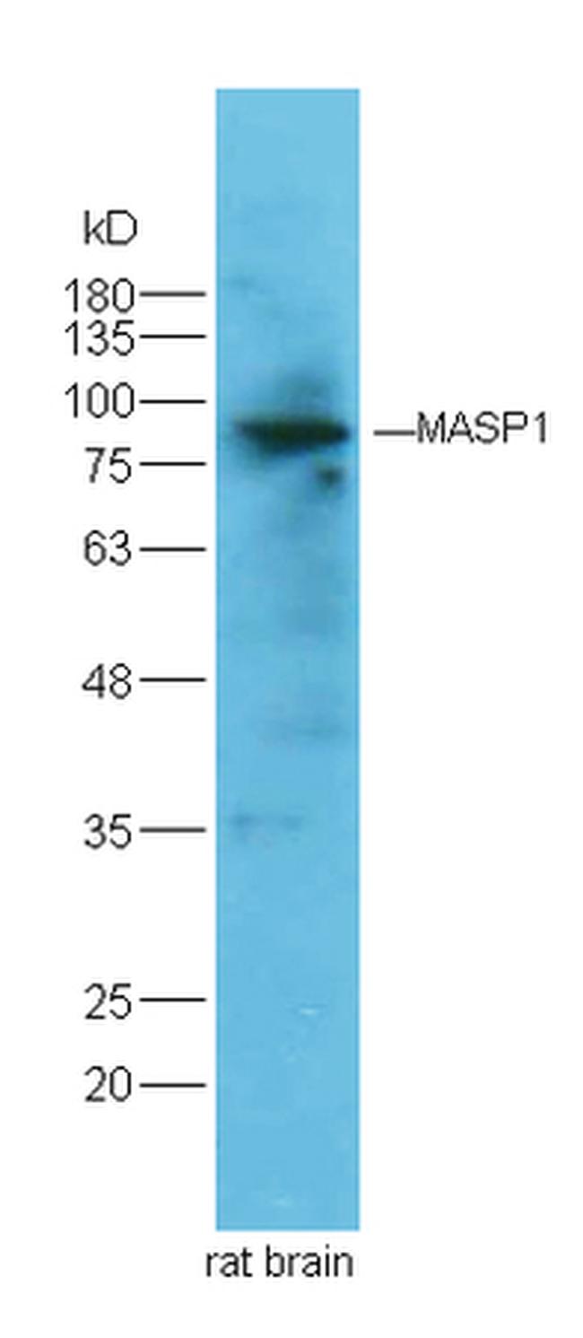 MASP Antibody in Western Blot (WB)