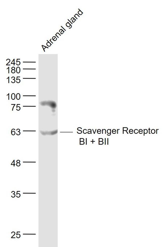 Scavenger Receptor BI/BII Antibody in Western Blot (WB)