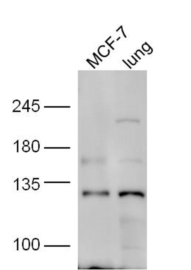 HNRPUL1 Antibody in Western Blot (WB)