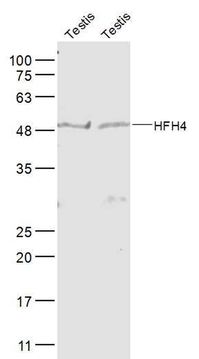 FOXJ1/HFH-4 Antibody in Western Blot (WB)