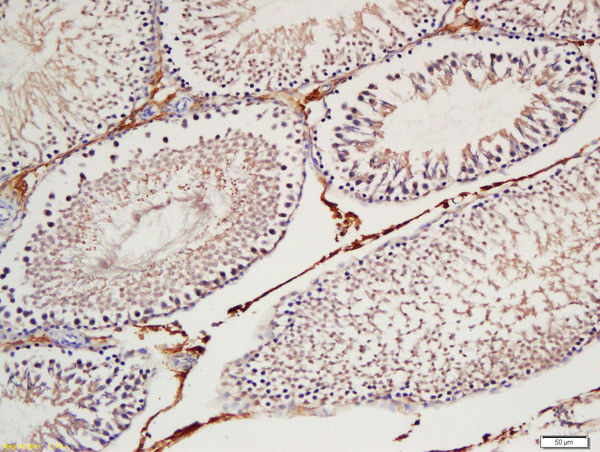 Cyclin H Antibody in Immunohistochemistry (Paraffin) (IHC (P))