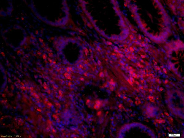 IL-12 Antibody in Immunohistochemistry (Paraffin) (IHC (P))