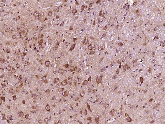 Phospho-IKB alpha (Ser36) Antibody in Immunohistochemistry (Paraffin) (IHC (P))